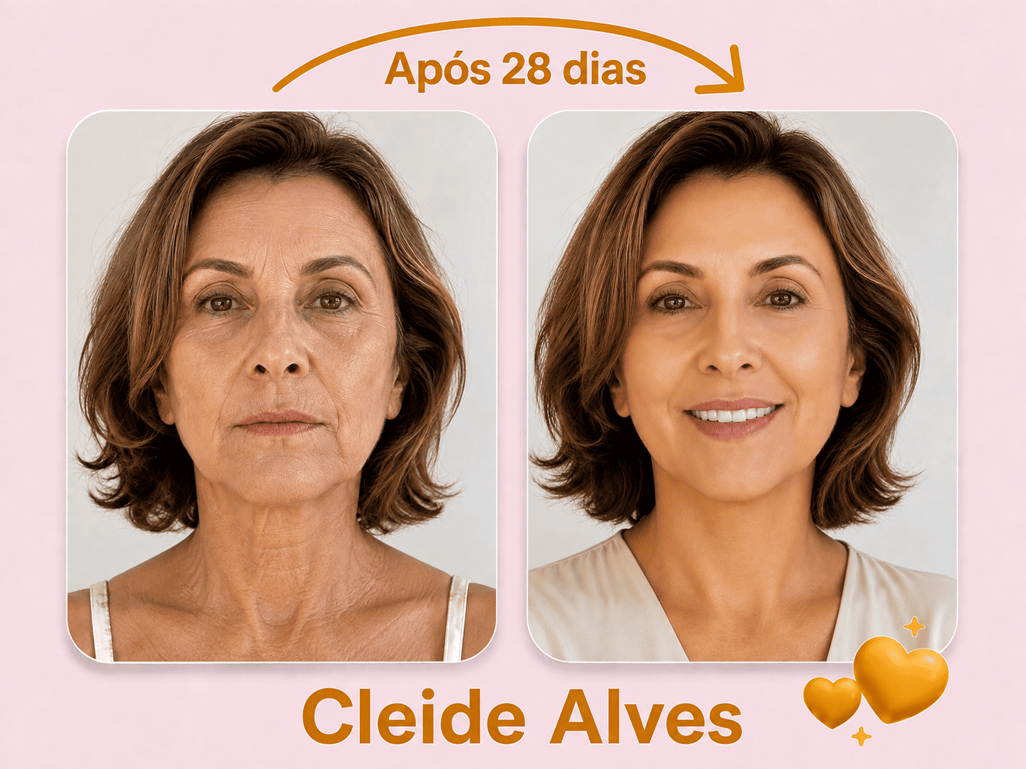 Antes e Depois